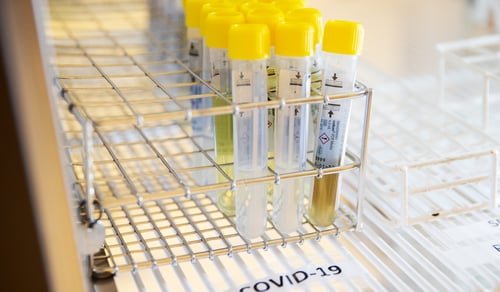 Laboratoriemedicin Gävle sjukhus, hälso- och sjukvård, covid-19.